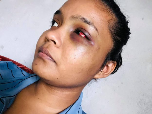 Young Guyanese Woman Cries for Justice from Domestic Violence